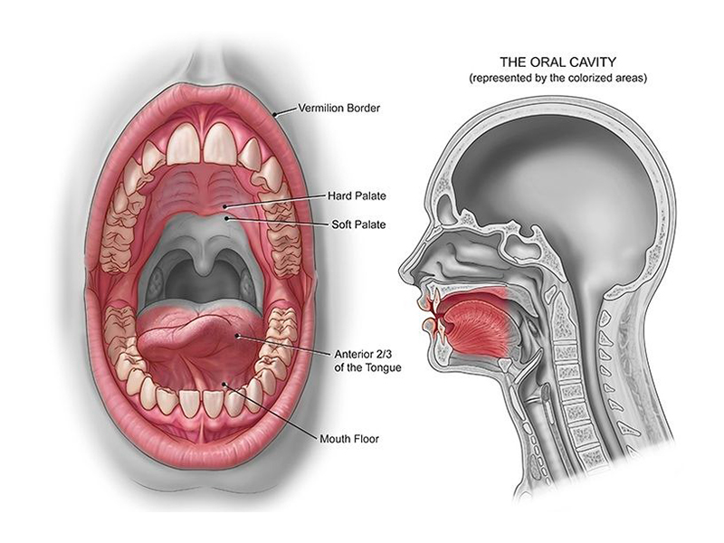 Oral Cancer Awareness: How to Detect Early Signs and Save Lives in Kerala